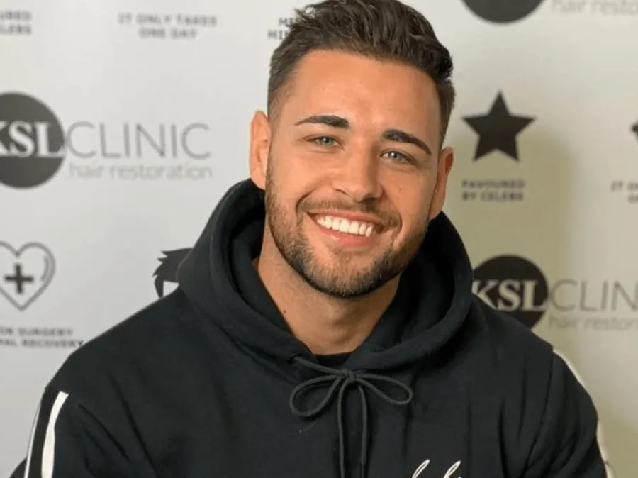 Love Island’s Kieran Nicholls at KSL Clinic for his six-month FUE hair transplant review with Dr Matee